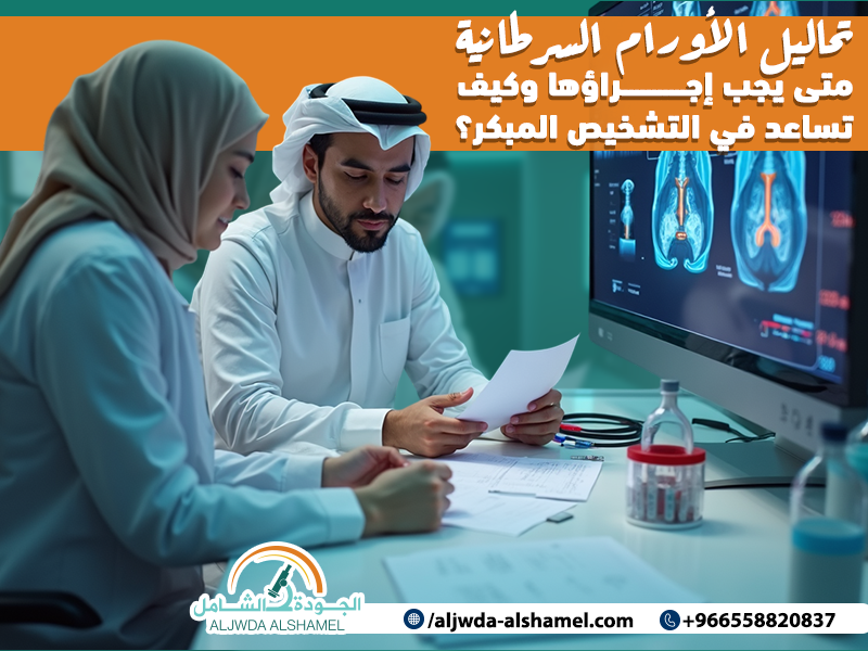 تحاليل الأورام السرطانية متى يجب إجراؤها وكيف تساعد في التشخيص المبكر؟